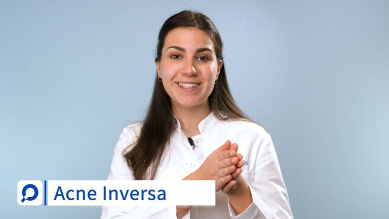 Exklusive Angebote f&uuml;r treue Kunden bei Akne-Behandlungen