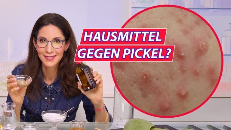 Nat&uuml;rliche Heilmittel gegen Akne