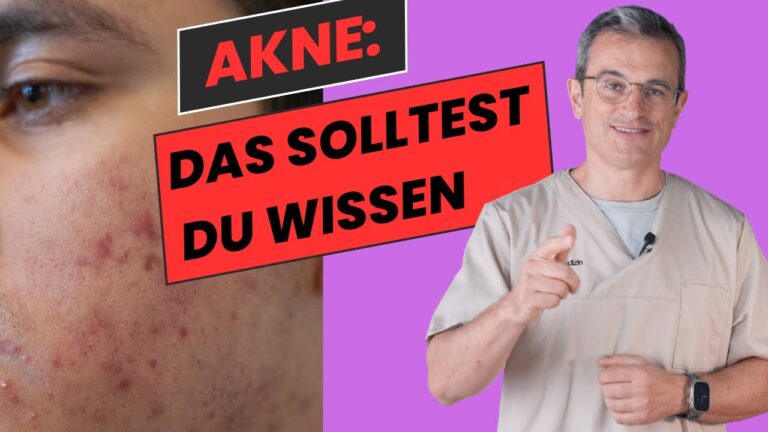 Erfahrungen mit dermatologischen Aknebehandlungen