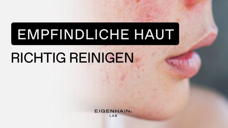 Die besten Aknebehandlungen f&uuml;r empfindliche Haut